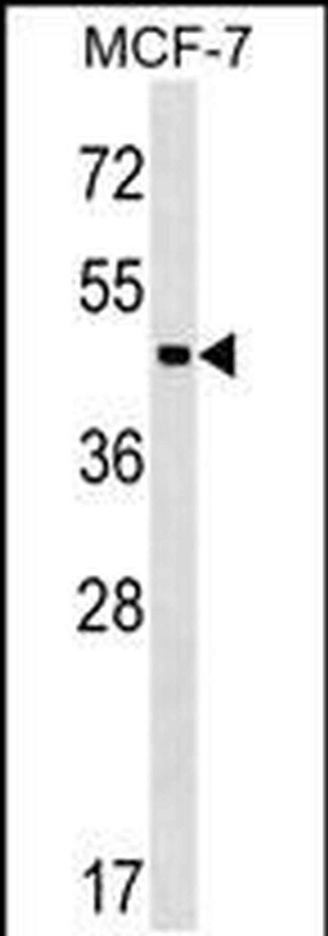 ZBTB12 Antibody in Western Blot (WB)