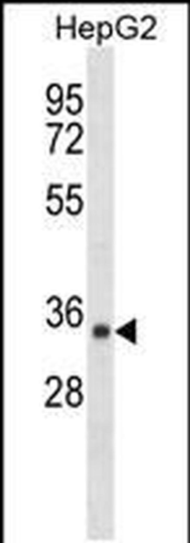 SDR39U1 Antibody in Western Blot (WB)