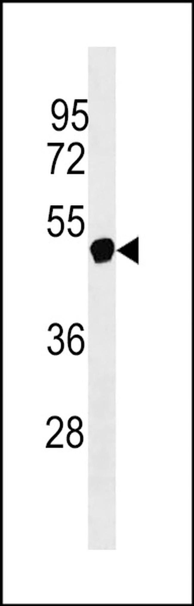 NXF5 Antibody in Western Blot (WB)