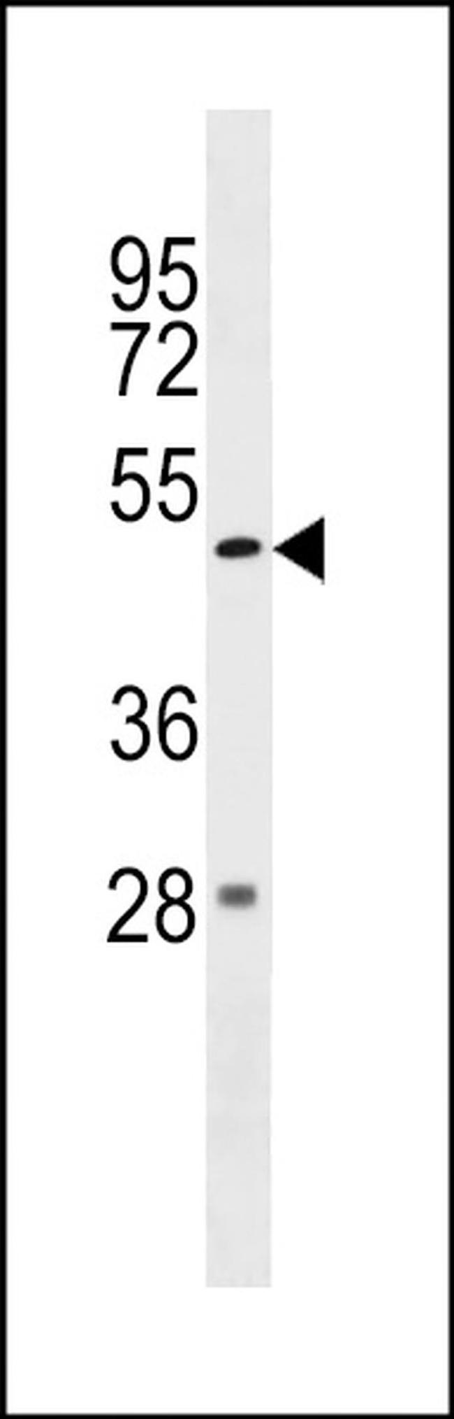ZBTB47 Antibody in Western Blot (WB)