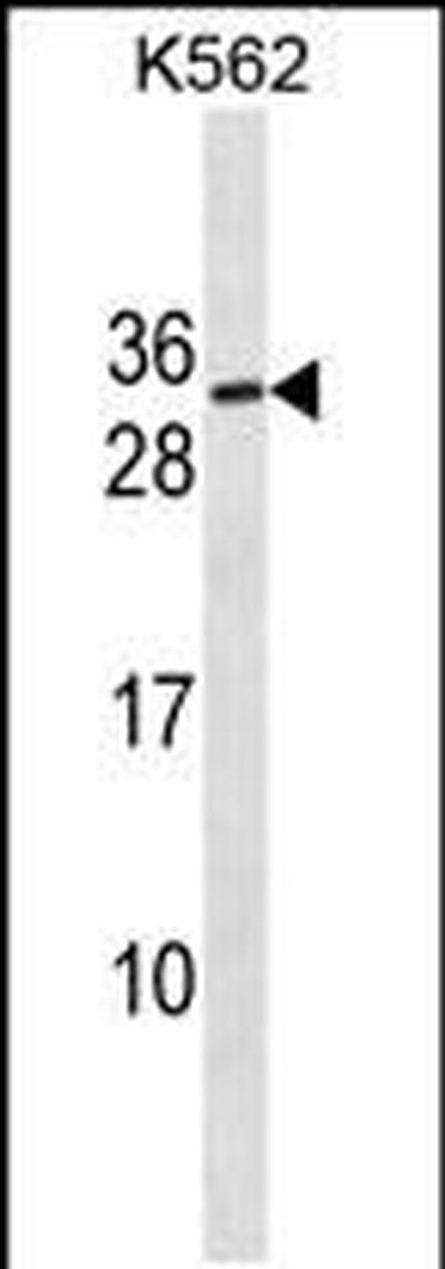 SSX3 Antibody in Western Blot (WB)