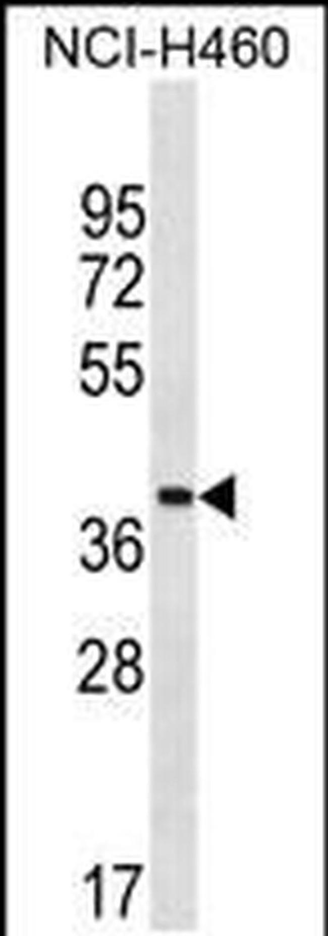 ZNF488 Antibody in Western Blot (WB)