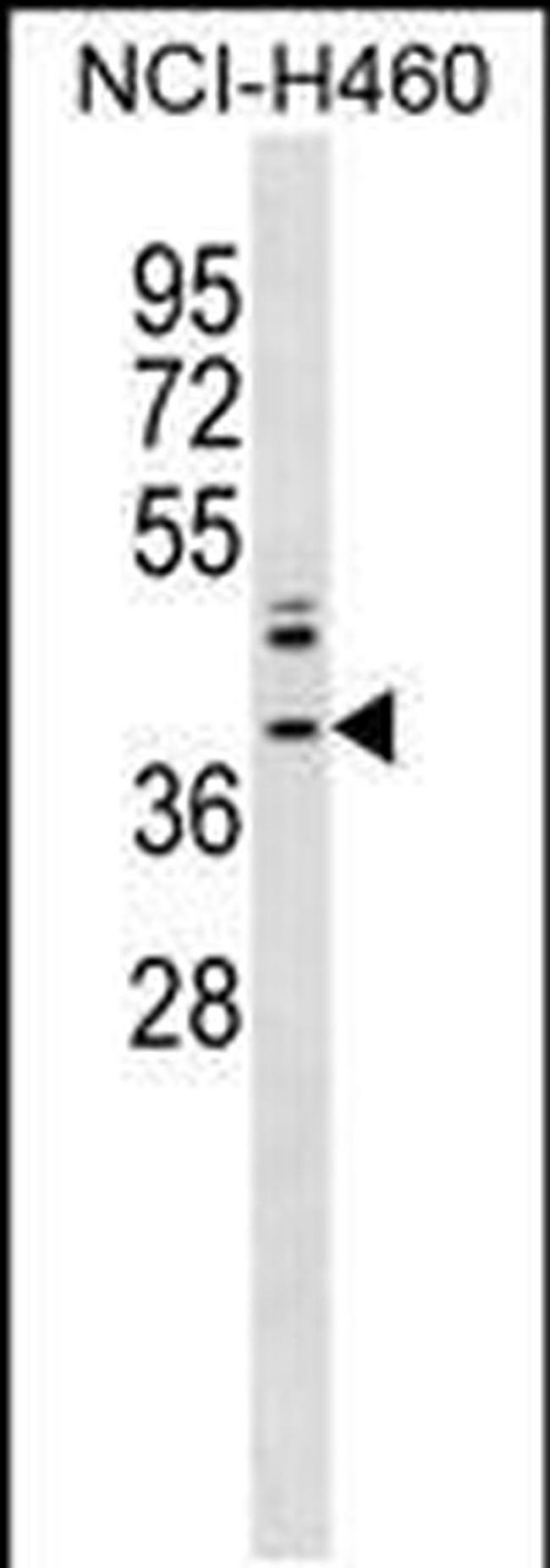 ZNF75A Antibody in Western Blot (WB)