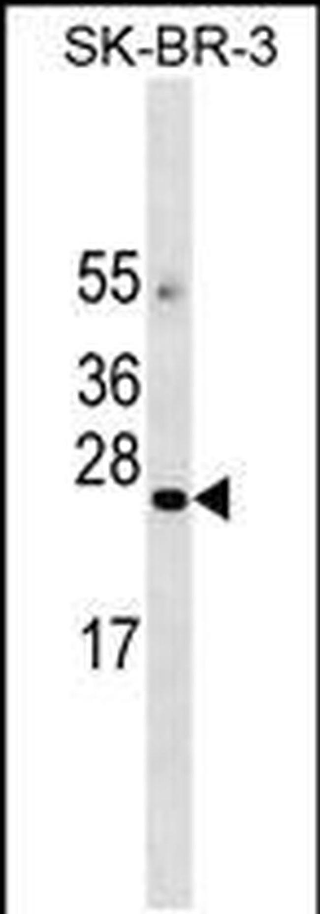 AGTRAP Antibody in Western Blot (WB)