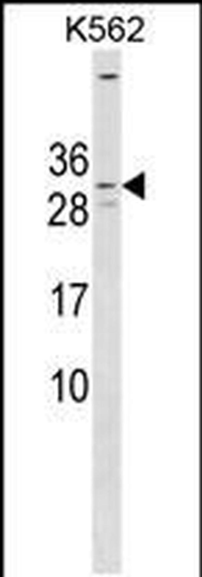 KCNE4 Antibody in Western Blot (WB)