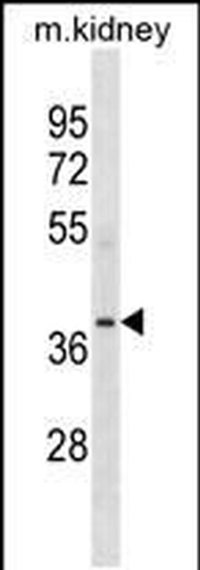 POC1A Antibody in Western Blot (WB)