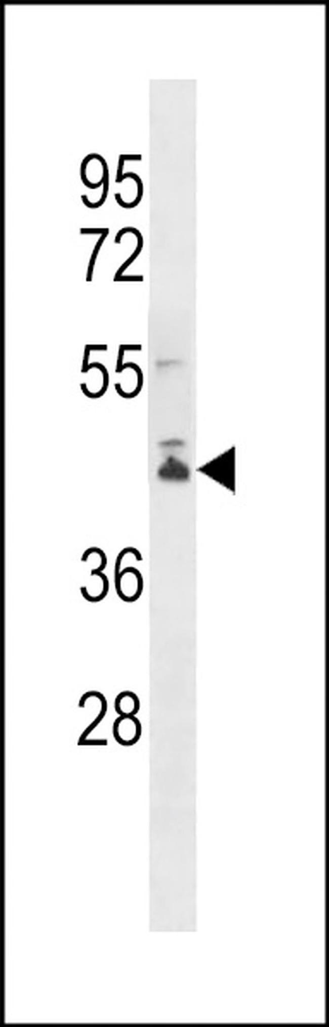 PCMTD2 Antibody in Western Blot (WB)
