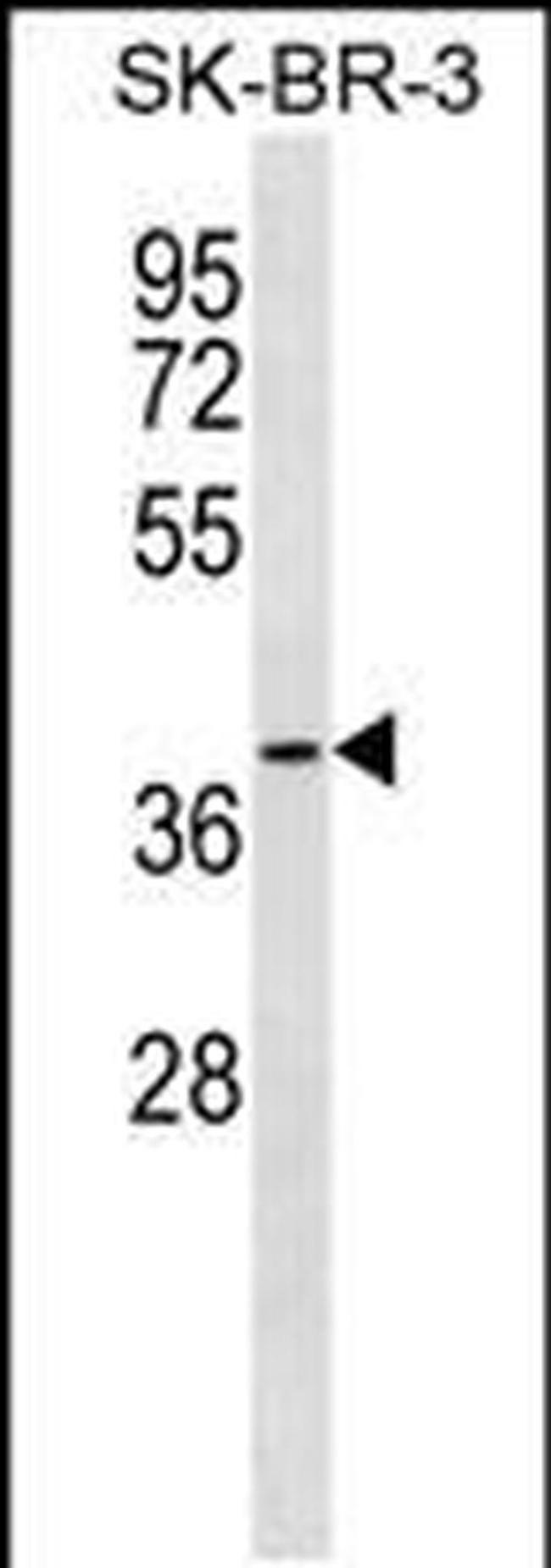 SFXN3 Antibody in Western Blot (WB)