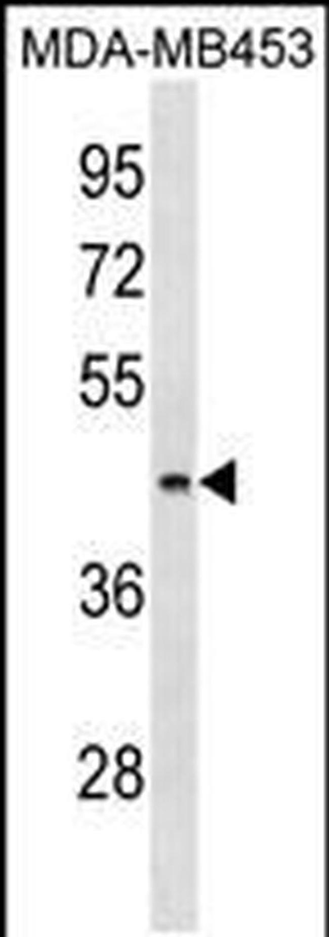 ALG8 Antibody in Western Blot (WB)
