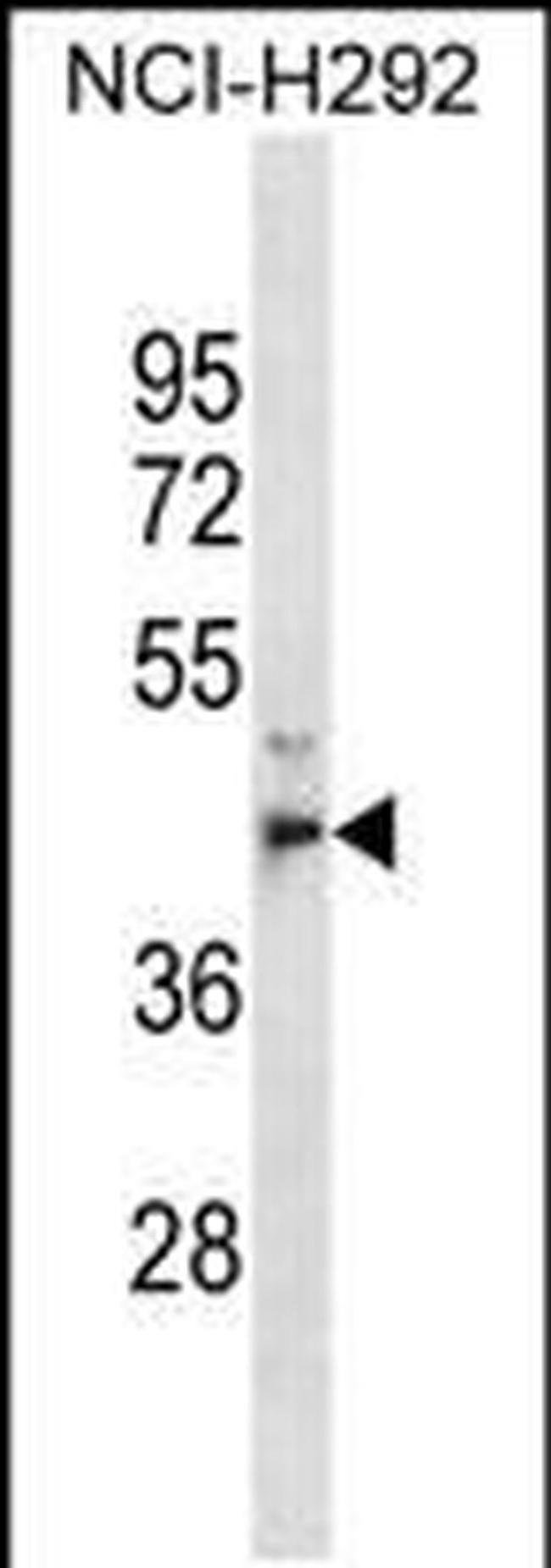 MPPE1 Antibody in Western Blot (WB)