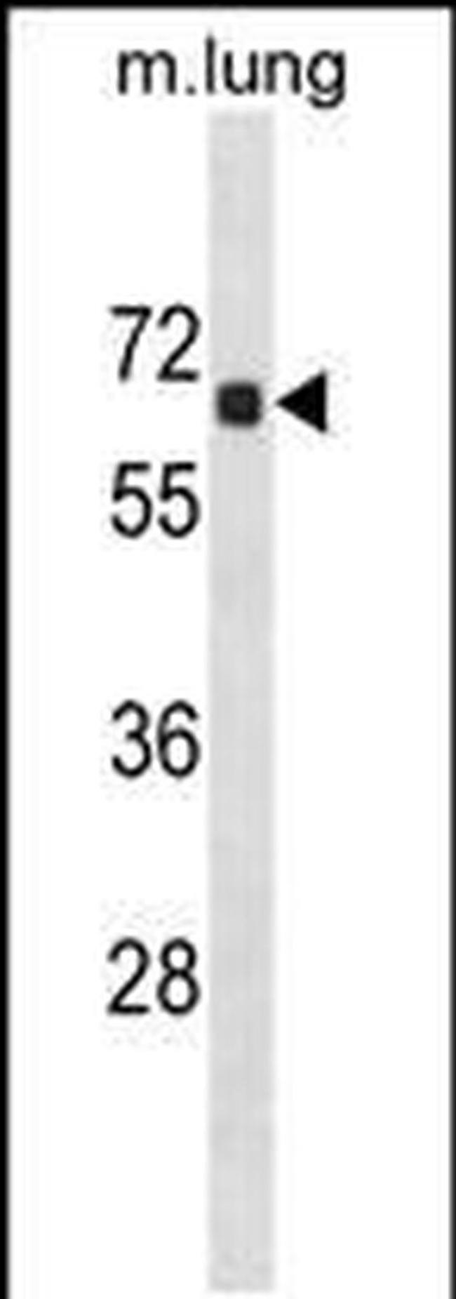 ACOT9 Antibody in Western Blot (WB)