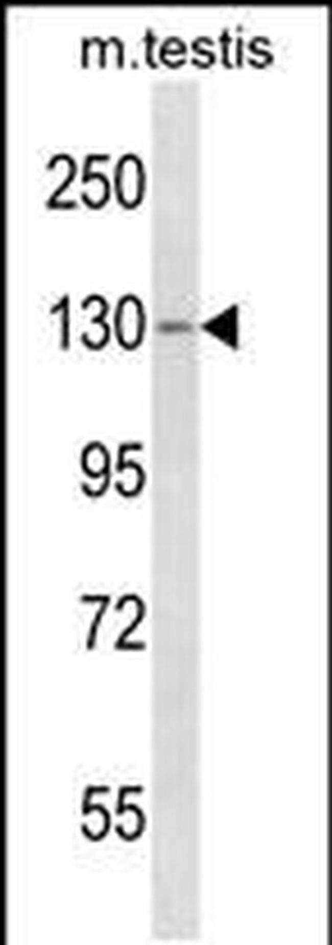 TBC1D2 Antibody in Western Blot (WB)