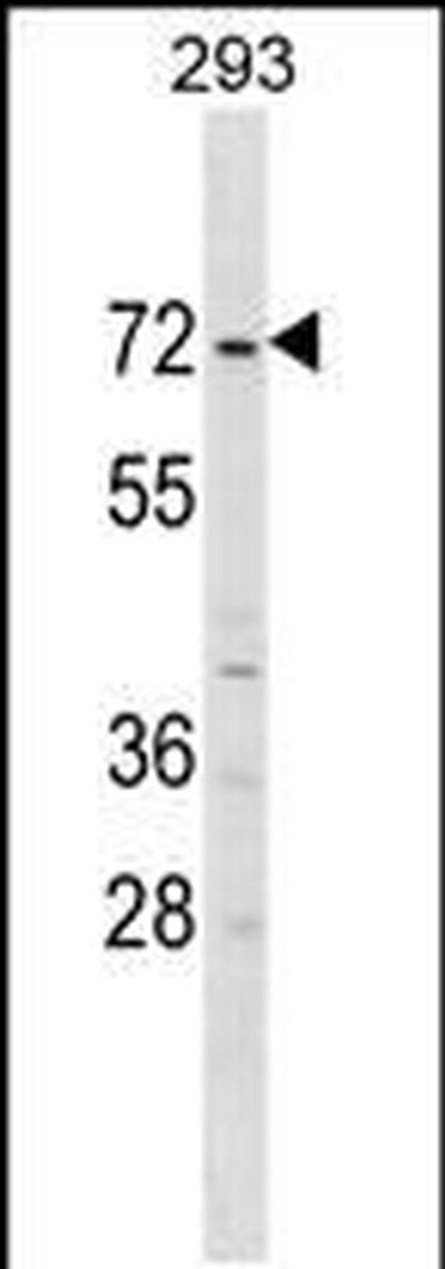 ZNF643 Antibody in Western Blot (WB)