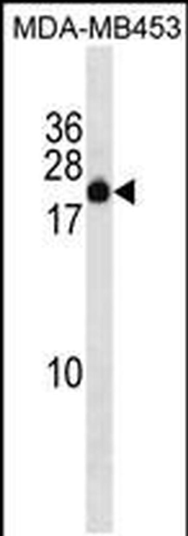 ZNF747 Antibody in Western Blot (WB)