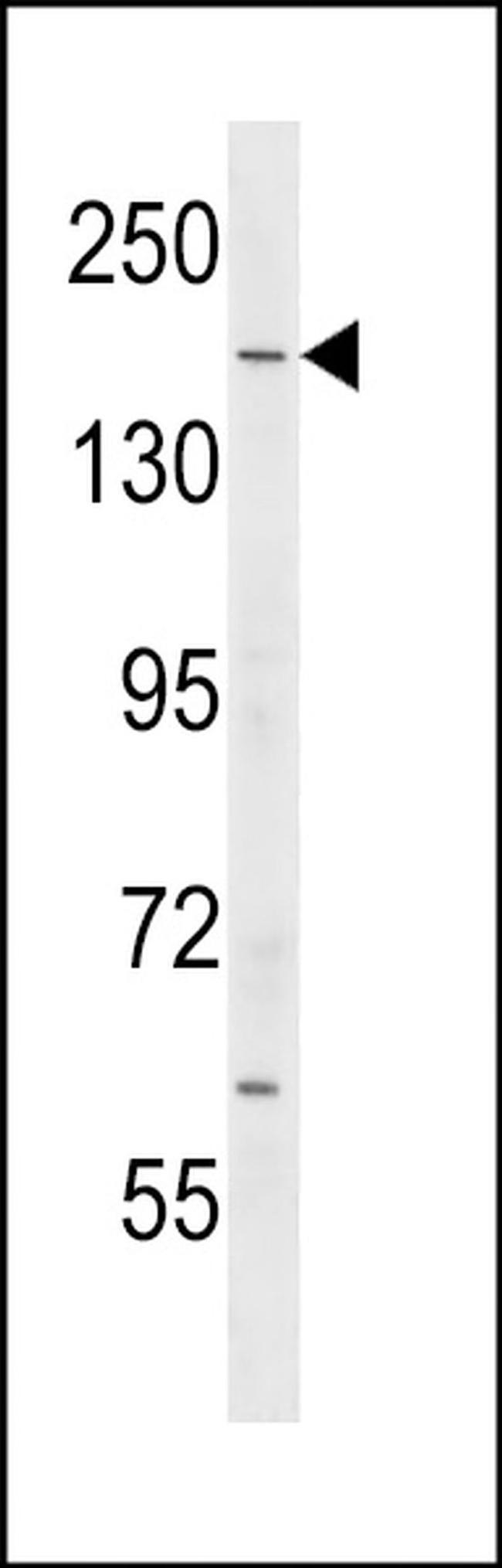 IQGAP2 Antibody in Western Blot (WB)