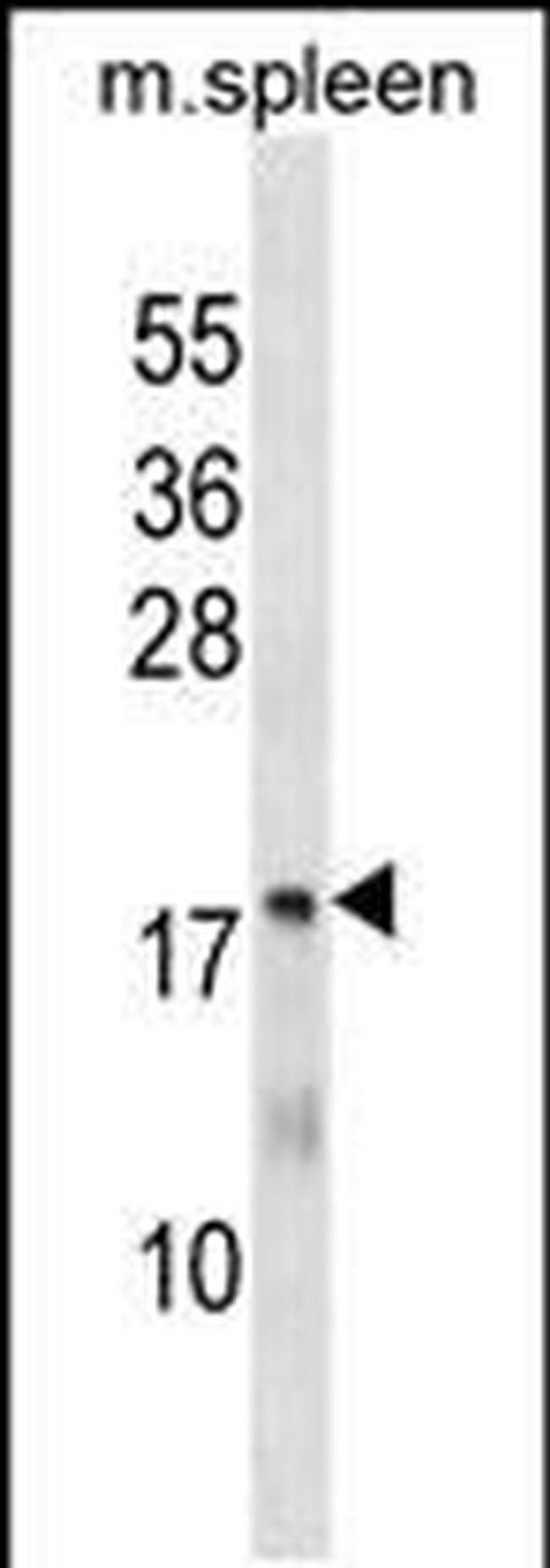 MTHFS Antibody in Western Blot (WB)