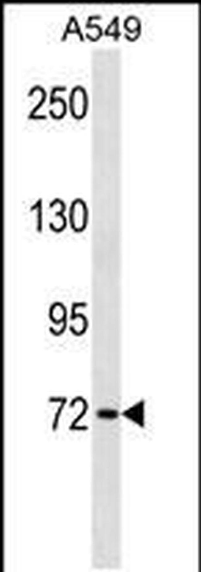 KBTBD7 Antibody in Western Blot (WB)