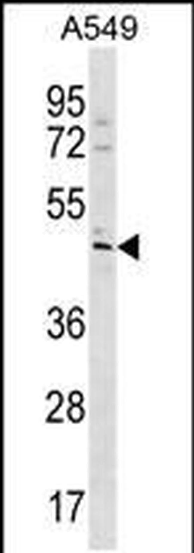 TBC1D20 Antibody in Western Blot (WB)