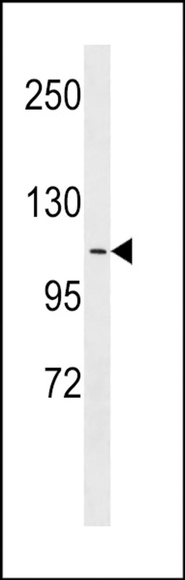 APOB48R Antibody in Western Blot (WB)