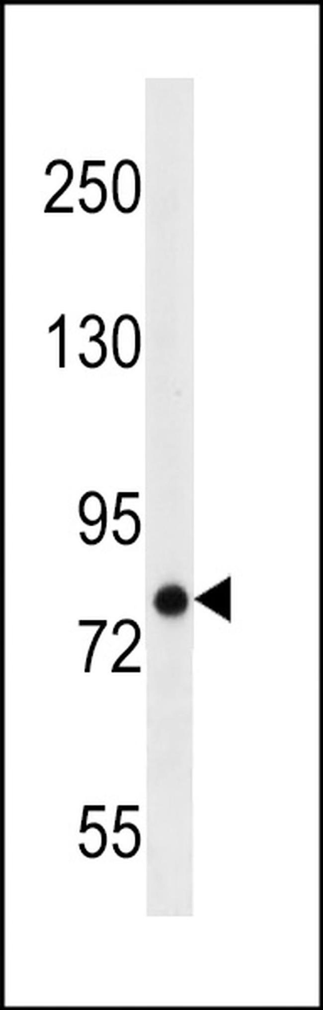 ARHGEF4 Antibody in Western Blot (WB)