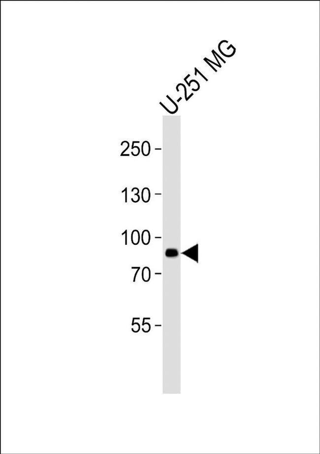 RFX4 Antibody in Western Blot (WB)