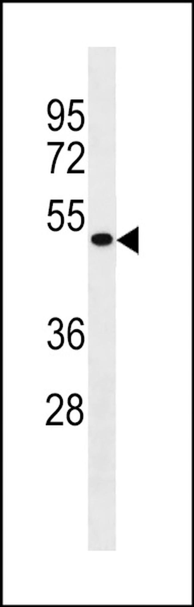 IDAS Antibody in Western Blot (WB)