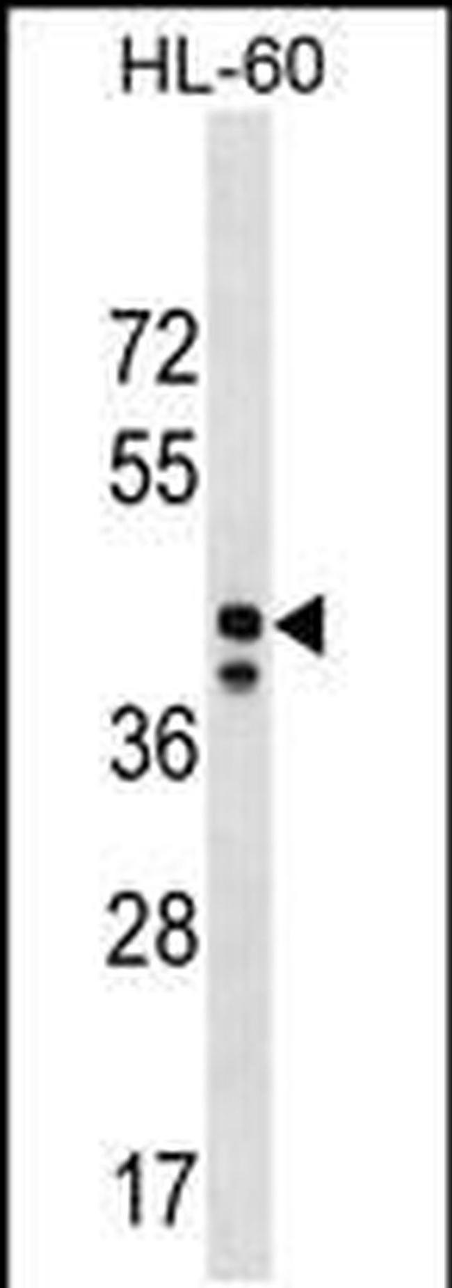 MRPS31 Antibody in Western Blot (WB)