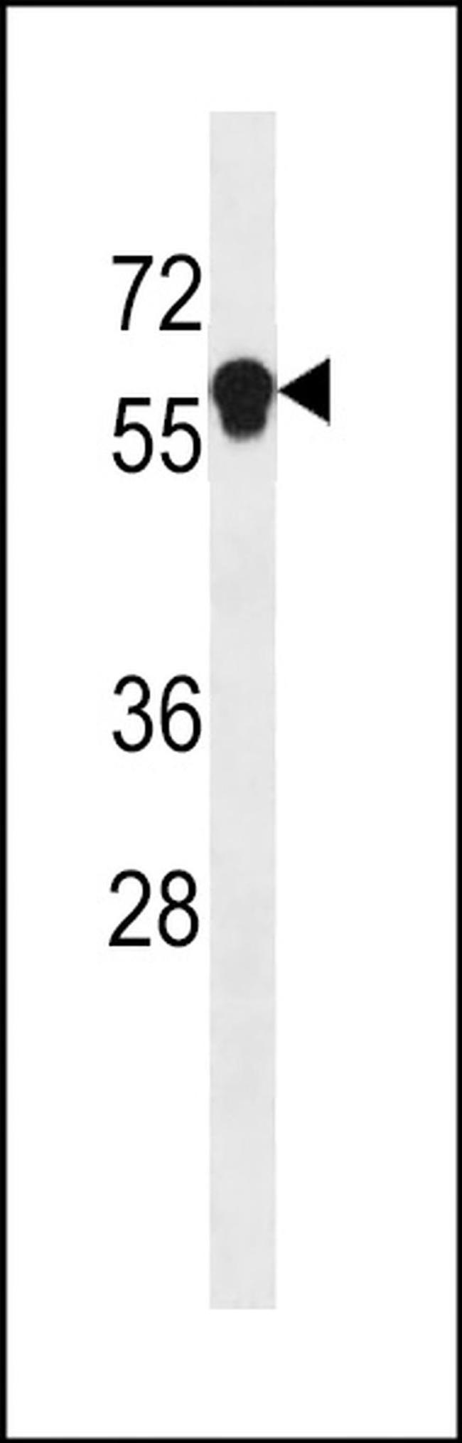 ANKDD1B Antibody in Western Blot (WB)
