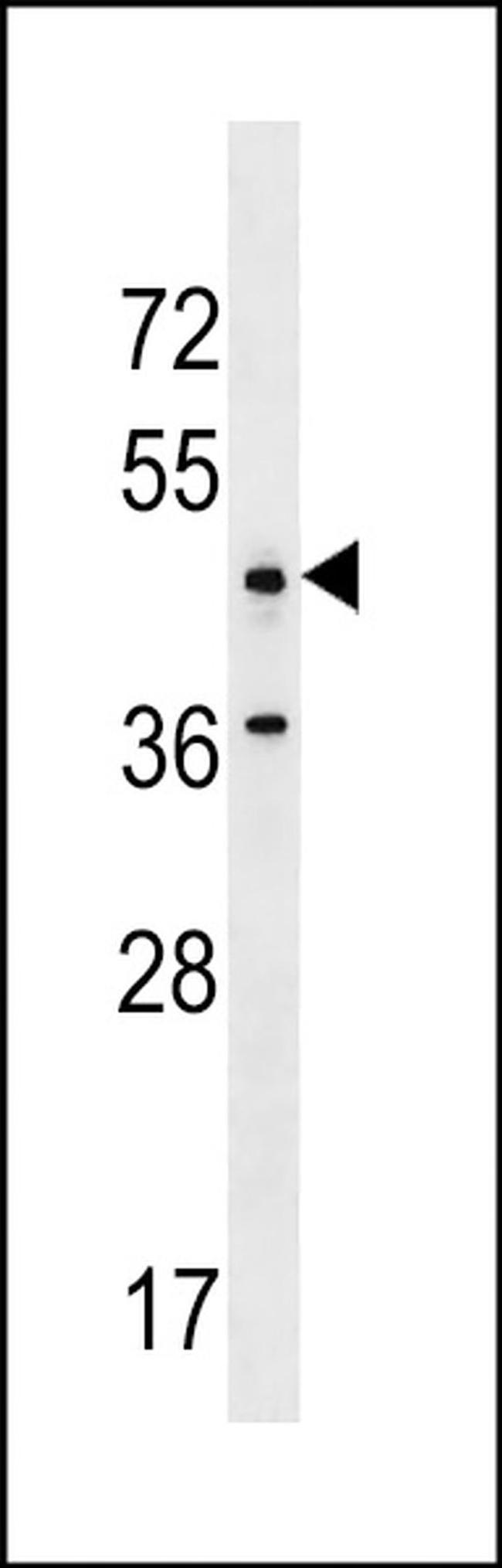ANKRD61 Antibody in Western Blot (WB)