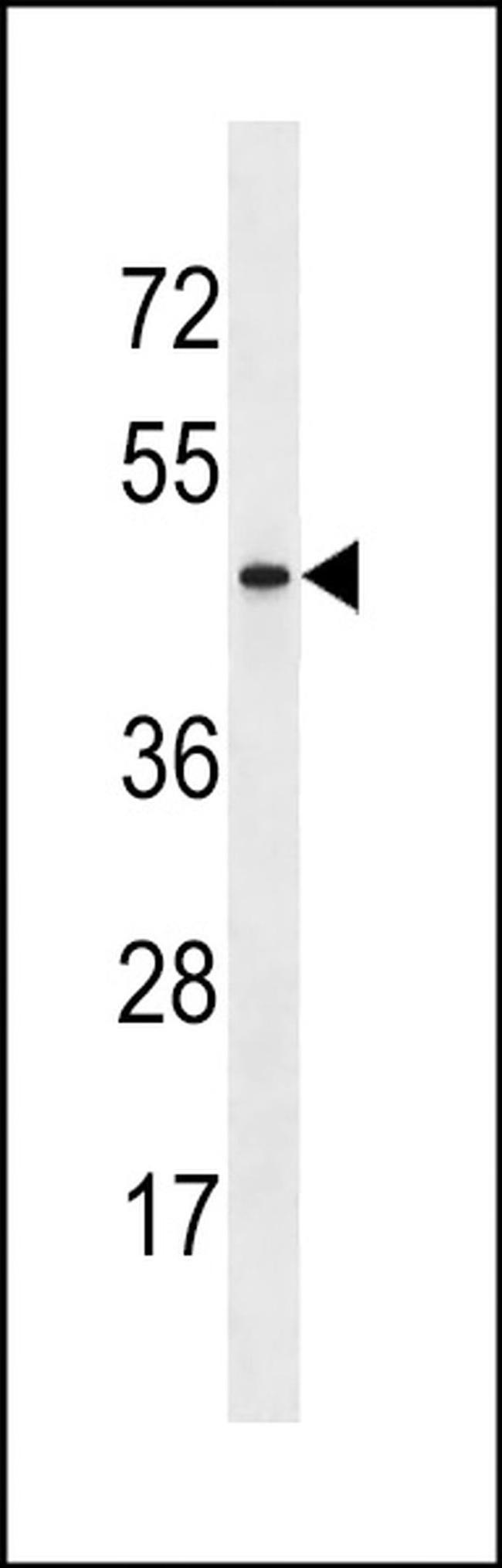 ARMCX4 Antibody in Western Blot (WB)