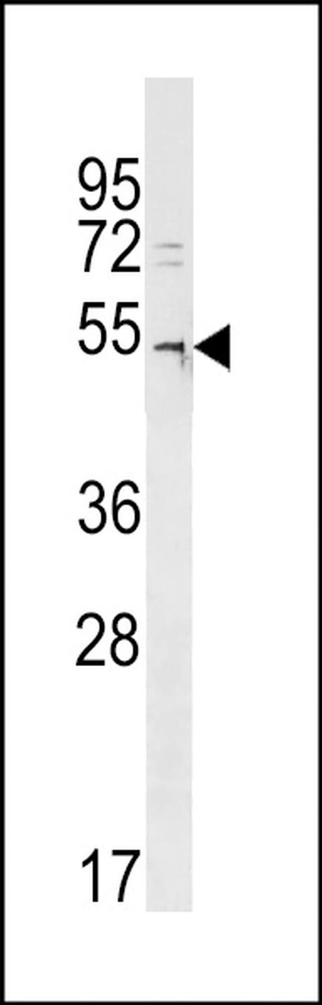 DCAF12L2 Antibody in Western Blot (WB)