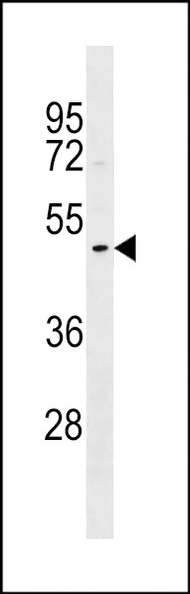DNASE1L1 Antibody in Western Blot (WB)