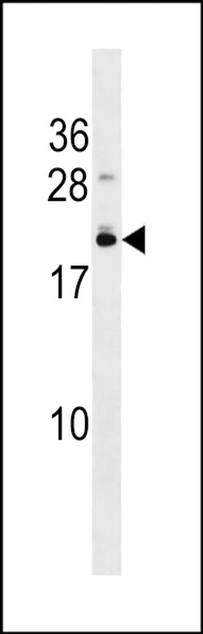 EFCAB10 Antibody in Western Blot (WB)