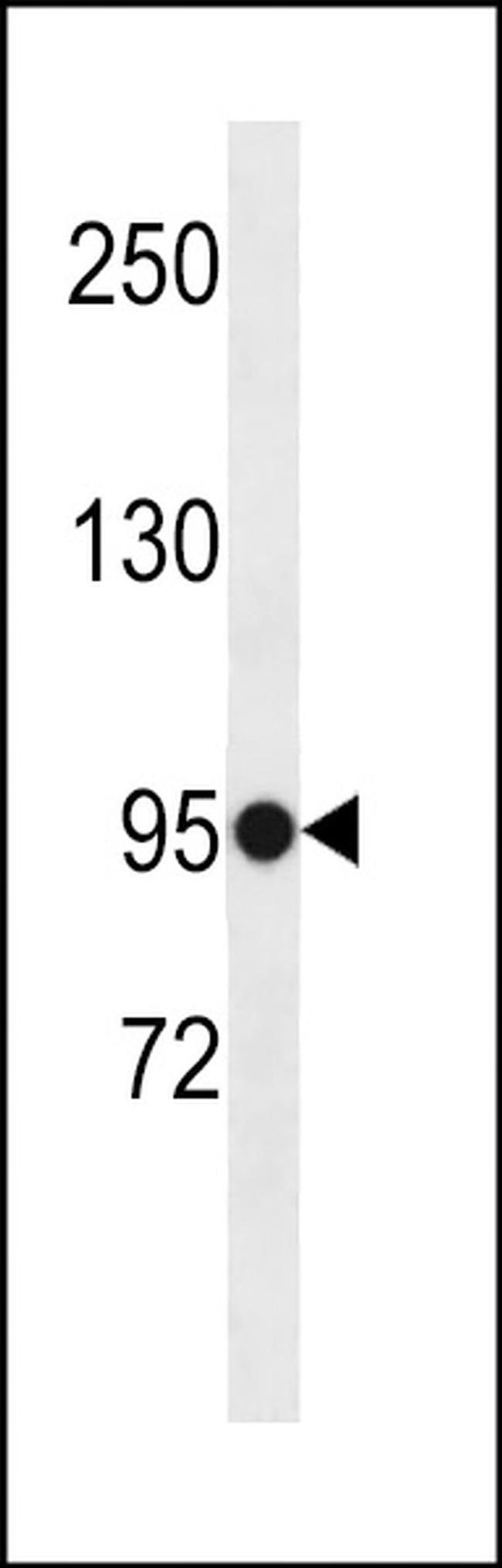 ELFN1 Antibody in Western Blot (WB)