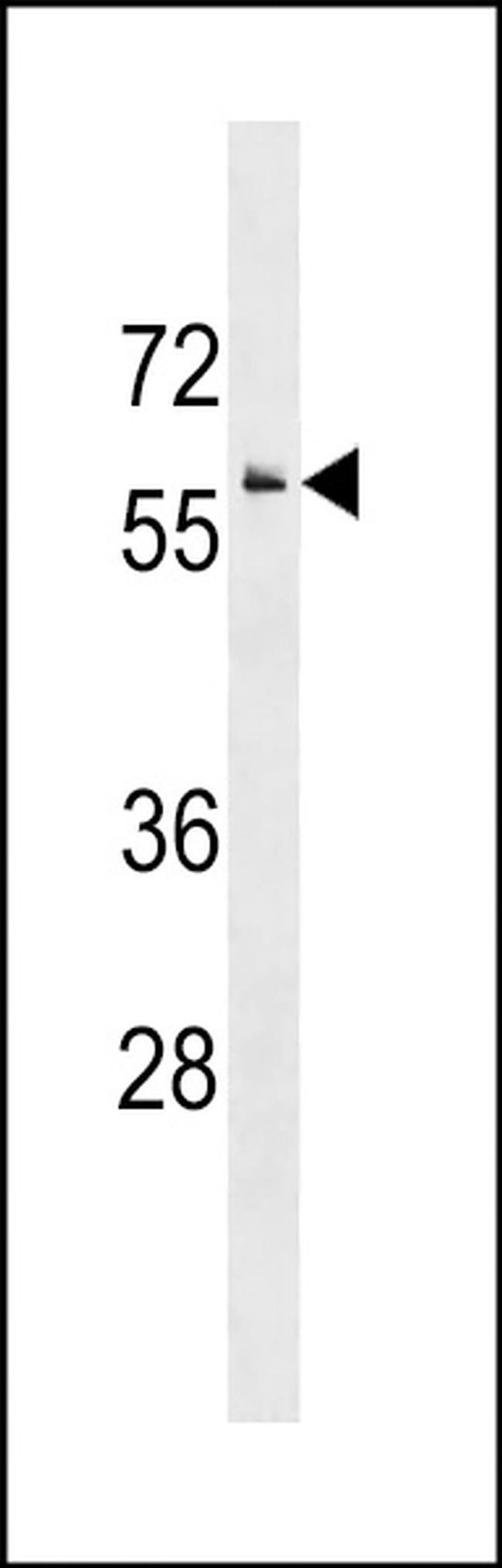IRG1 Antibody in Western Blot (WB)