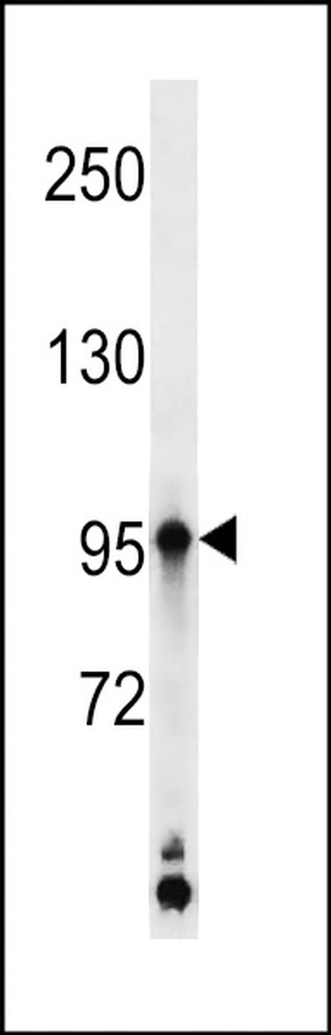 Kazrin Antibody in Western Blot (WB)