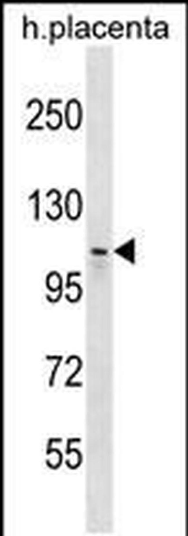 MMS19 Antibody in Western Blot (WB)
