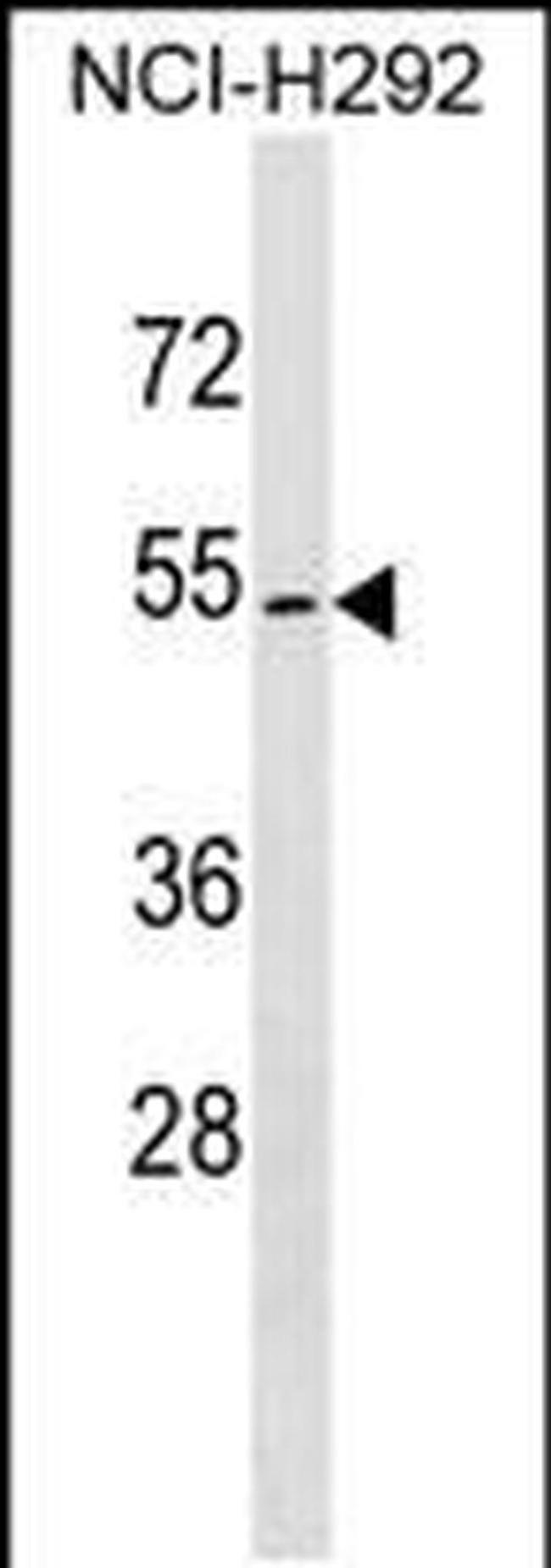 ZPLD1 Antibody in Western Blot (WB)