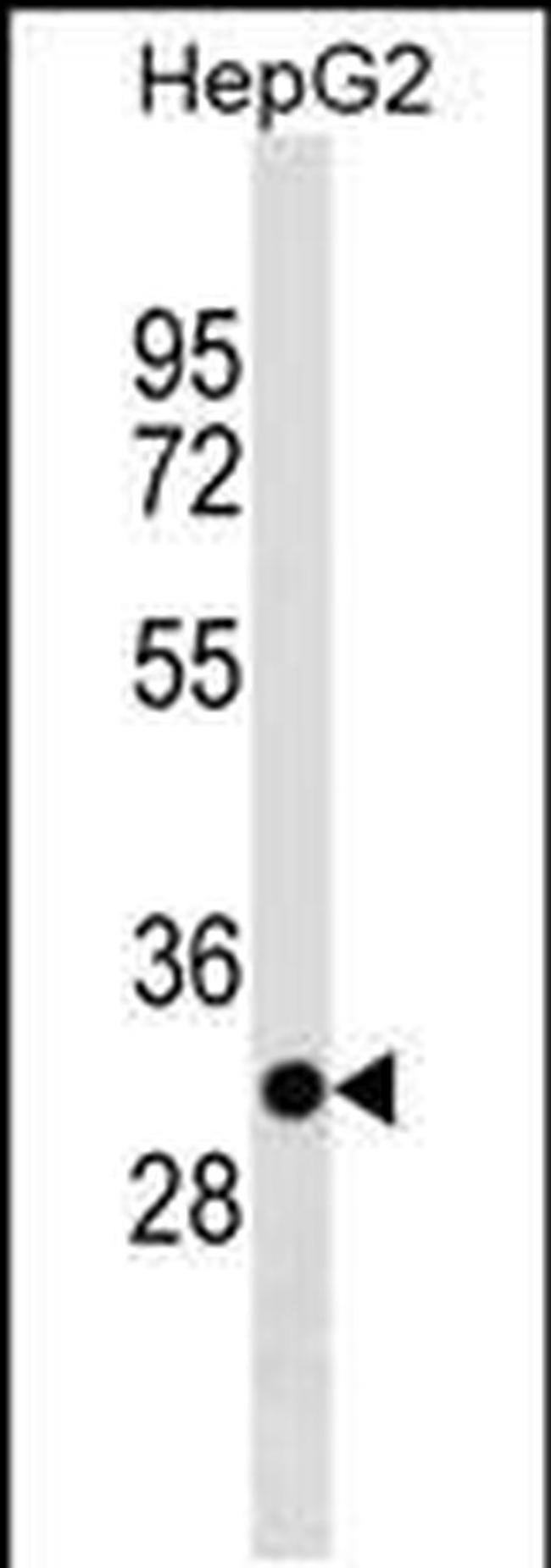 TARM1 Antibody in Western Blot (WB)