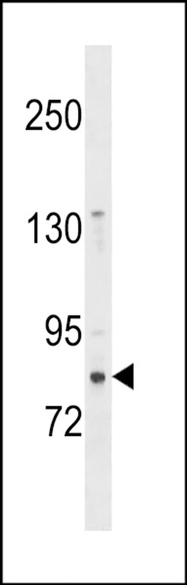 ZNF853 Antibody in Western Blot (WB)