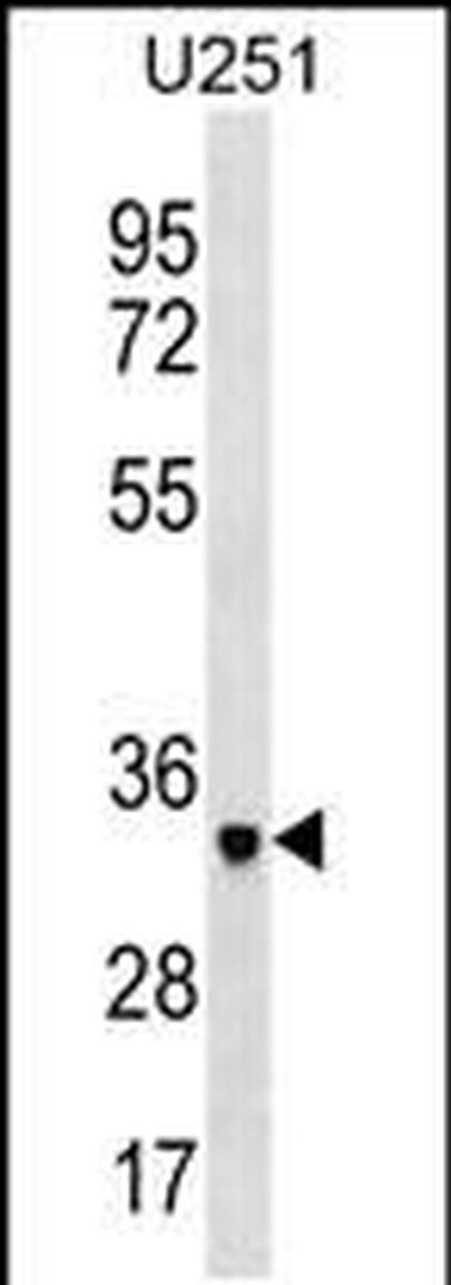 NPL Antibody in Western Blot (WB)