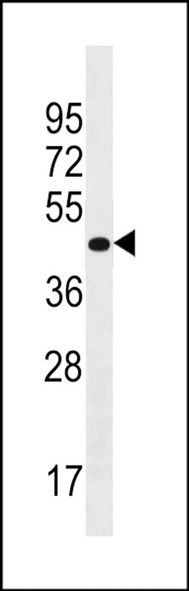 PRR25 Antibody in Western Blot (WB)