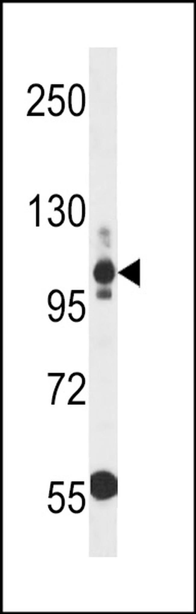 Thrombospondin 3 Antibody in Western Blot (WB)