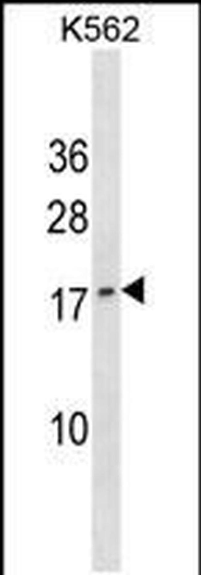 GCHFR Antibody in Western Blot (WB)