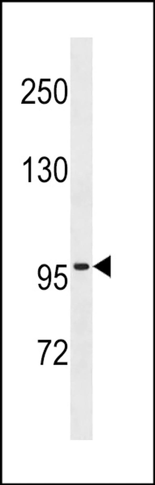 ZNF229 Antibody in Western Blot (WB)