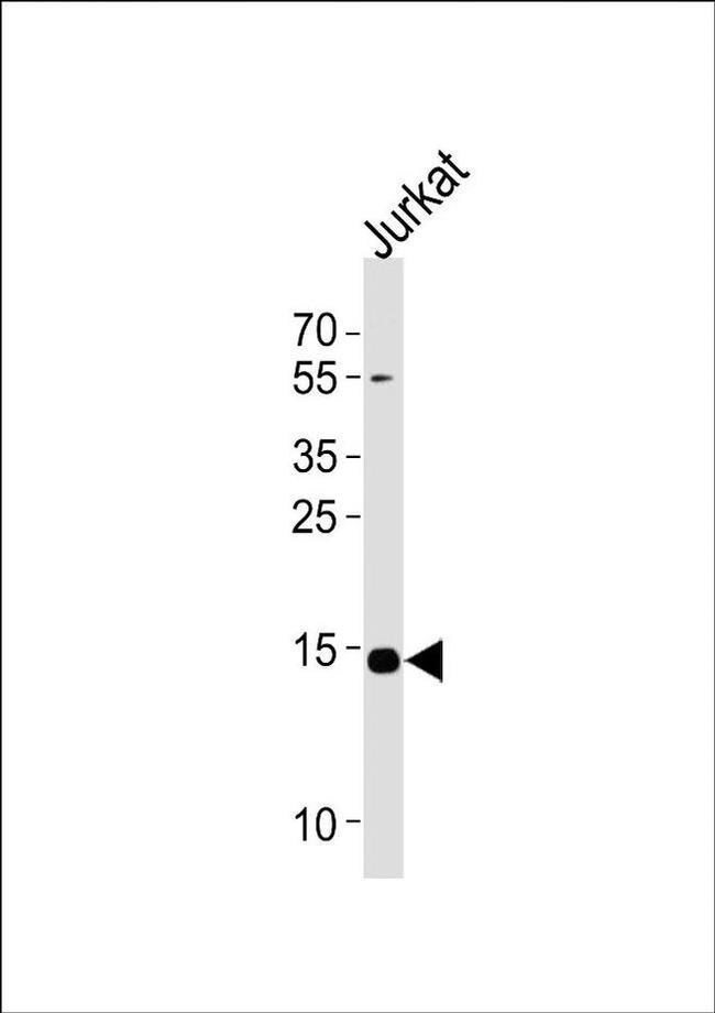 UBE2D4 Antibody in Western Blot (WB)