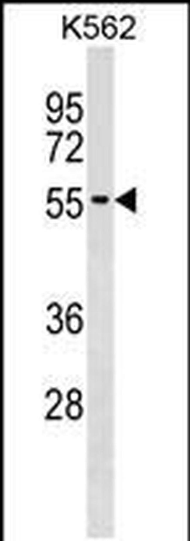 UTP3 Antibody in Western Blot (WB)