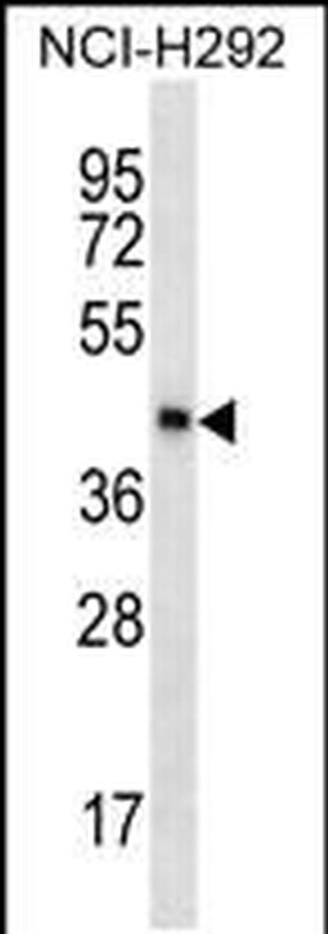 SPESP1 Antibody in Western Blot (WB)