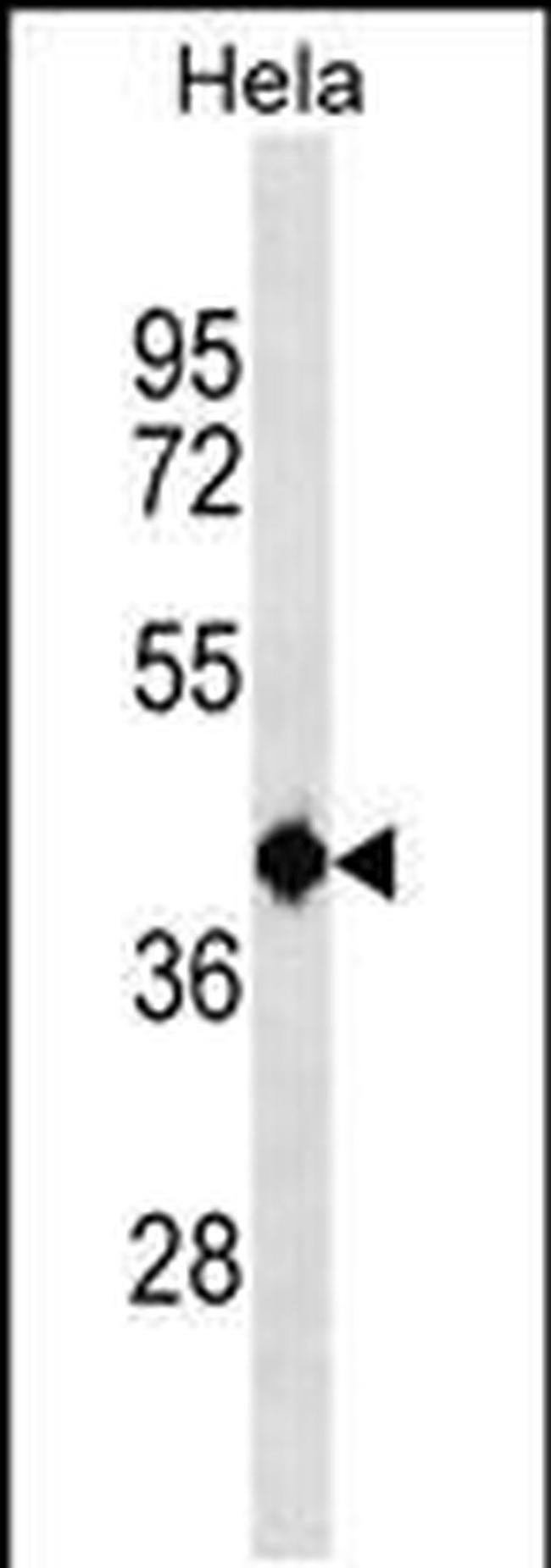 TSEN2 Antibody in Western Blot (WB)