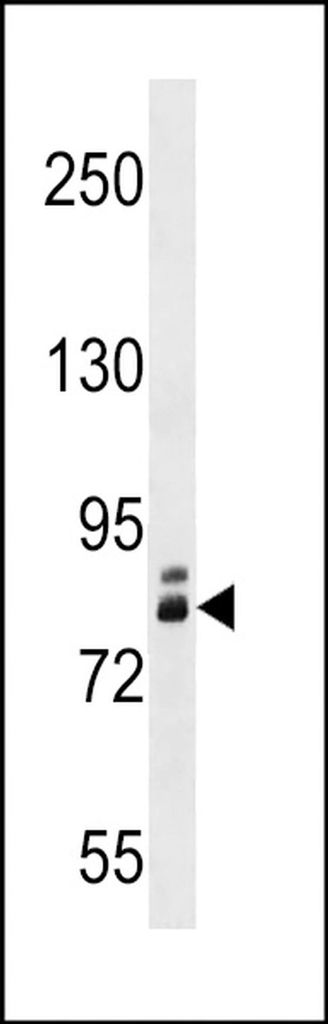 ZNF252 Antibody in Western Blot (WB)